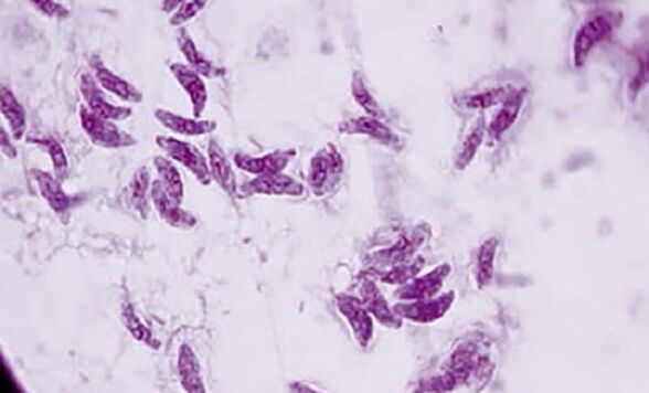 protozojski parazit toxoplasma gondii uzročnik toksoplazmoze