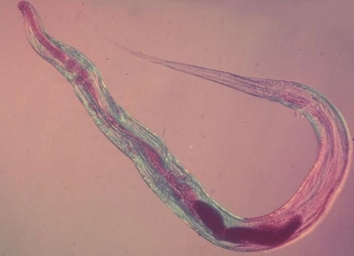 Pinworm pod mikroskopom