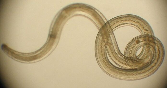 parazit crva iz ljudskog tijela