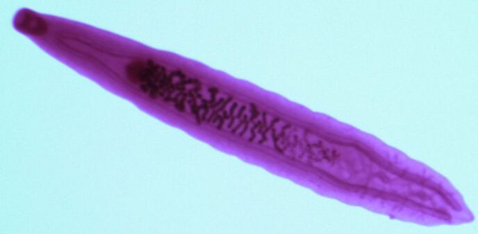 parazit metilja iz ljudskog tijela