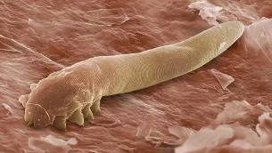 Paraziti u ljudskom tijelu
