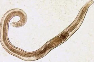 paraziti osoba threadworm